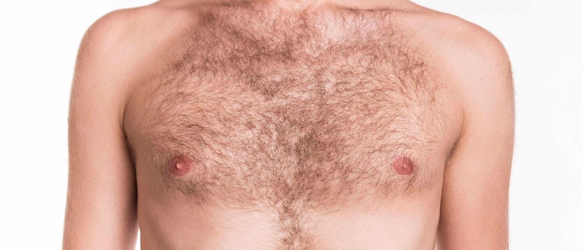 Chest Hair Removal
